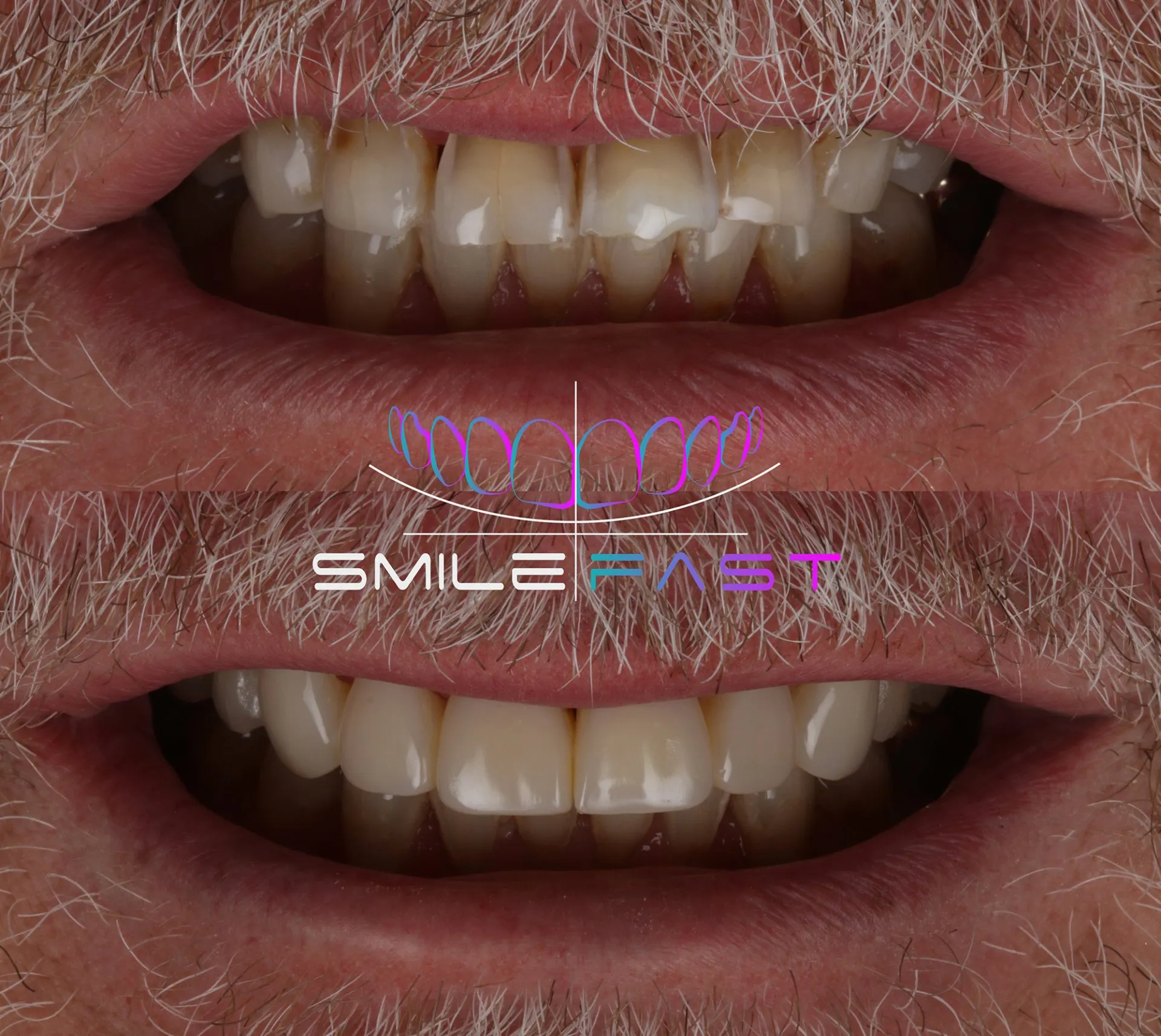Before+After+Example+1-2880w