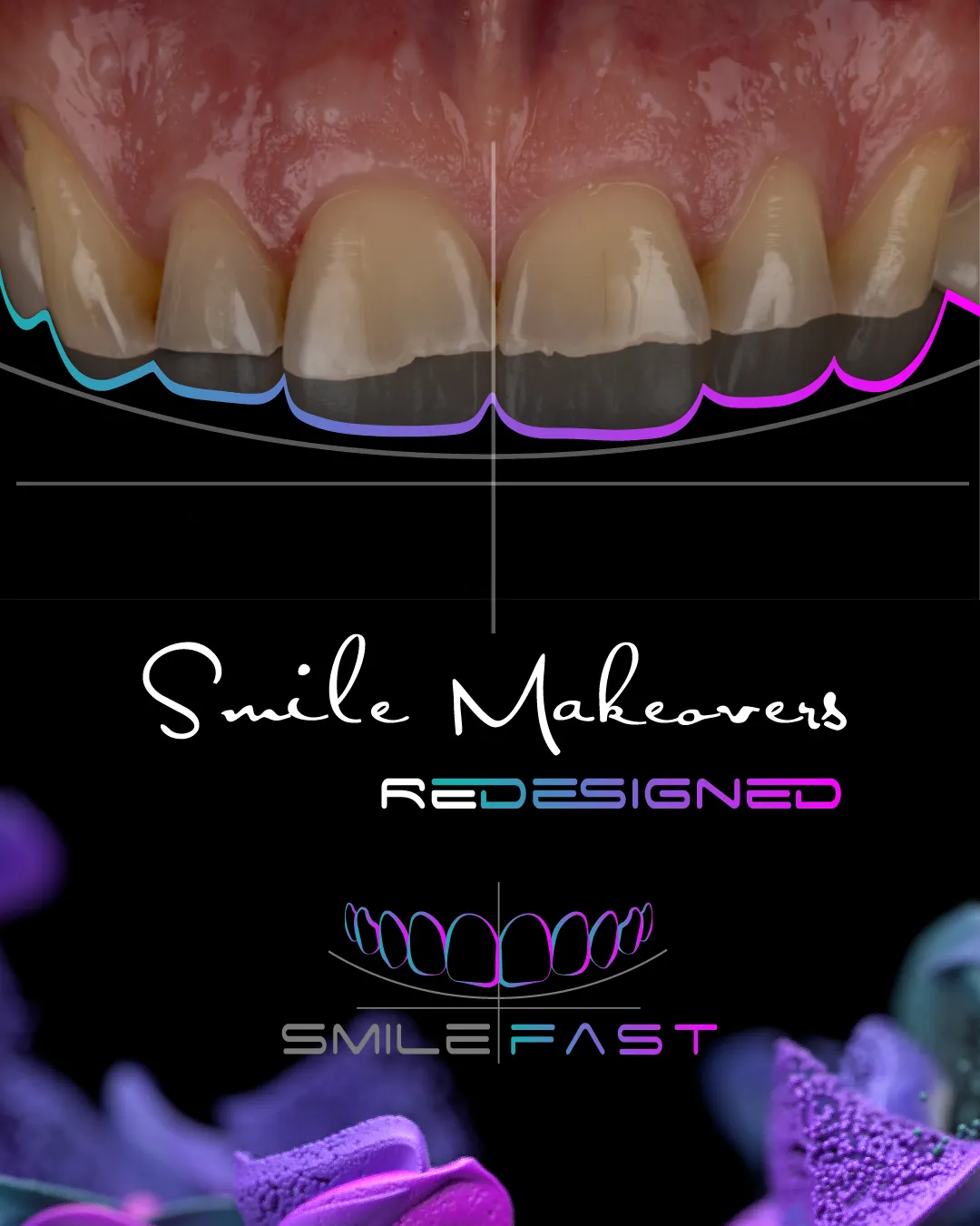 SmilefastArtboard+7-2880w
